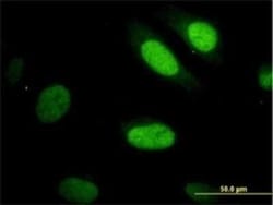 YAP1 Antibody (2F12) - Isoform 5, Novus Biologicals 0.1 mg | Buy Online | Novus Biologicals | Fisher Scientific