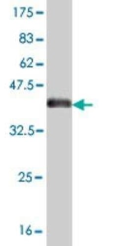 YAP1 Antibody (2F12) - Isoform 5, Novus Biologicals 0.1 mg | Buy Online | Novus Biologicals | Fisher Scientific