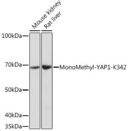 YAP1 Rabbit anti-Human, Mouse, Rat, Polyclonal, Novus Biologicals 20 &mu;g;