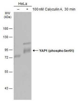 YAP1, p Ser61 Antibody, Novus Biologicals 100 &mu;g | Buy Online | Novus Biologicals | Fisher Scientific