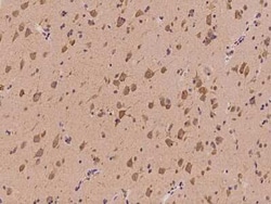 YARS Antibody, Novus Biologicals 50 &mu;g, Unconjugated:Antibodies, Polyclonal
