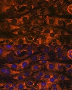 YB1 Rabbit anti-Human, Mouse, Rat, Clone: 9J7M4, Novus Biologicals 100