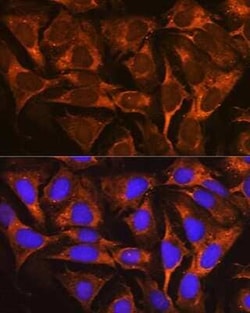 YB1 Rabbit anti-Human, Mouse, Rat, Clone: 9J7M4, Novus Biologicals 100