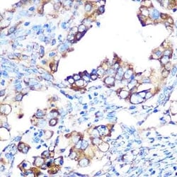 YB1 Rabbit anti-Human, Mouse, Rat, Clone: 9J7M4, Novus Biologicals 100