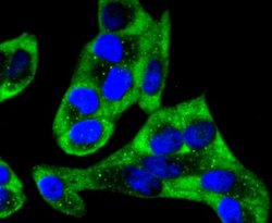 YB1 Antibody (ST0432), Novus Biologicals 100&mu;L:Antibodies, Monoclonal