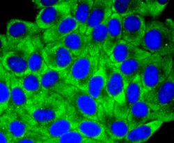 YB1 Antibody (ST0432), Novus Biologicals 100&mu;L:Antibodies, Monoclonal