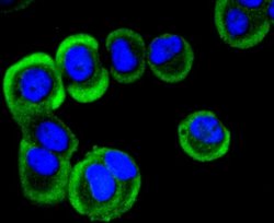 YB1 Antibody (ST0432), Novus Biologicals 100&mu;L:Antibodies, Monoclonal