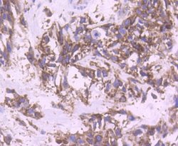 YB1 Antibody (ST0432), Novus Biologicals 100&mu;L:Antibodies, Monoclonal