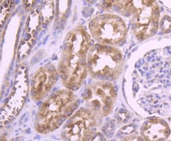 YB1 Antibody (ST0432), Novus Biologicals 100&mu;L:Antibodies, Monoclonal