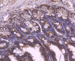 YB1 Antibody (ST0432), Novus Biologicals 100&mu;L:Antibodies, Monoclonal