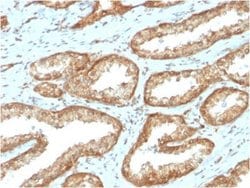 YB1 Antibody (YBX1/2430) - Azide and BSA Free, Novus Biologicals 100 &mu;g;