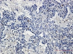 YB1 Antibody (S03-6G4), Novus Biologicals:Antibodies:Primary Antibodies