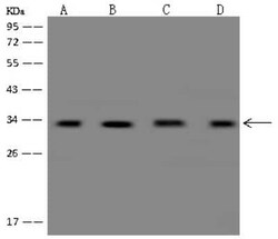 YB1 Antibody, Novus Biologicals 100 &mu;g, Unconjugated:Antibodies, Polyclonal
