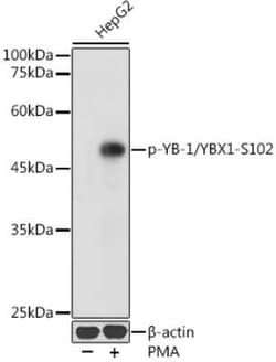 YB1 Rabbit anti-Human, Polyclonal, Novus Biologicals 20 &mu;g; Unconjugated:Antibodies,