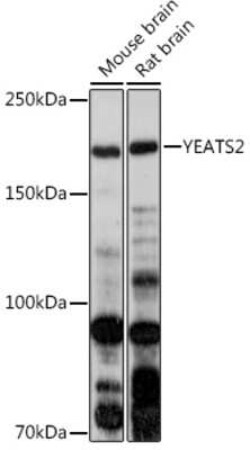YEATS2 Rabbit anti-Human, Mouse, Rat, Polyclonal, Novus Biologicals 20 &mu;g | Buy Online | Bio-Techne | Fisher Scientific