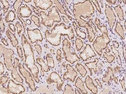 YIPF4 Antibody, Novus Biologicals 50 &mu;g, Unconjugated:Antibodies, Polyclonal