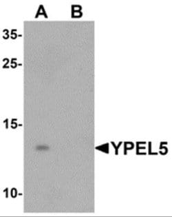YPEL5 Antibody - BSA Free, Novus Biologicals 0.1 mg; Unconjugated:Antibodies,