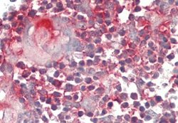 YRDC Rabbit anti-Human, Polyclonal, Novus Biologicals 0.1 mL | Buy Online | Novus Biologicals | Fisher Scientific