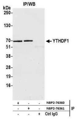 YTHD1 Antibody, Novus Biologicals 100 &mu;L; Unconjugated:Antibodies, Polyclonal