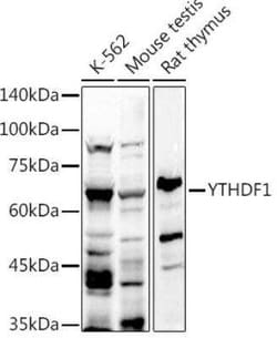 YTHD1 Antibody - Azide and BSA Free, Novus Biologicals 0.02 mL; Unconjugated:Antibodies,