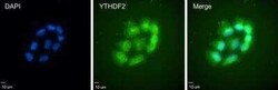 YTHDF2 Antibody, Novus Biologicals 50 &mu;g | Buy Online | Novus Biologicals | Fisher Scientific