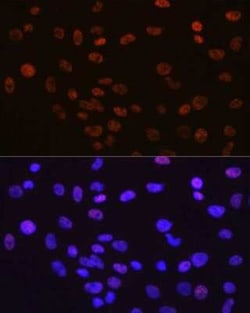 YY1 Rabbit anti-Human, Mouse, Rat, Clone: 6J6L1, Novus Biologicals 100