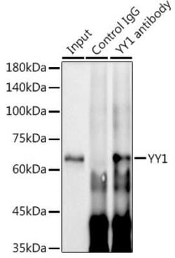 YY1 Rabbit anti-Human, Mouse, Rat, Clone: 6J6L1, Novus Biologicals 100