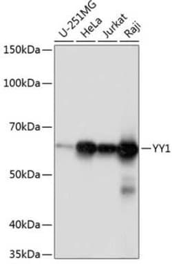 YY1 Rabbit anti-Human, Mouse, Rat, Clone: 6J6L1, Novus Biologicals 100