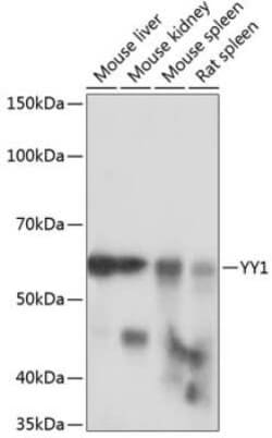 YY1 Rabbit anti-Human, Mouse, Rat, Clone: 6J6L1, Novus Biologicals 100