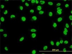 YY1 Antibody (2C4), Novus Biologicals 0.1 mg | Buy Online | Novus Biologicals | Fisher Scientific