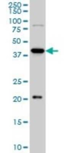 YY1 Antibody (2C4), Novus Biologicals 0.1 mg | Buy Online | Novus Biologicals | Fisher Scientific