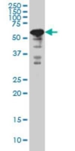 YY1 Antibody (2C5), Novus Biologicals 0.1 mg | Buy Online | Novus Biologicals | Fisher Scientific