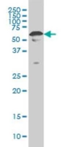 YY1 Antibody (4A5), Novus Biologicals 0.1 mg | Buy Online | Novus Biologicals | Fisher Scientific