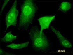 YY1AP1 Antibody (2G7), Novus Biologicals 0.1 mg | Buy Online | Novus Biologicals | Fisher Scientific