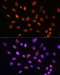 YY2 Antibody - Azide and BSA Free, Novus Biologicals:Antibodies:Primary