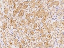 ZADH1 Antibody, Novus Biologicals 50 &mu;g; Unconjugated:Antibodies, Polyclonal