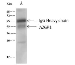 ZAG Antibody, Novus Biologicals:Antibodies:Primary Antibodies