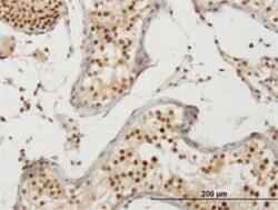 ZAK Antibody (3G5), Novus Biologicals 100 &mu;g | Buy Online | Novus Biologicals | Fisher Scientific