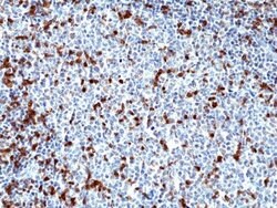 ZAP70 Antibody (RM408), Novus Biologicals 100 &mu;L; Unconjugated:Antibodies,