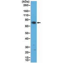 ZAP70 Antibody (RM408), Novus Biologicals 100 &mu;L; Unconjugated:Antibodies,