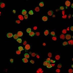 ZAP70 Antibody (2F3.2), Novus Biologicals 0.1mg; Unlabeled:Antibodies,