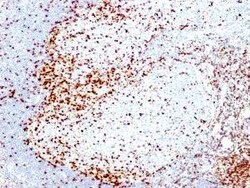 ZAP70 Antibody (2F3.2), Novus Biologicals 0.1mg; Unlabeled:Antibodies,