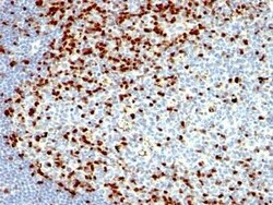 ZAP70 Antibody (SPM362), Novus Biologicals:Antibodies:Primary Antibodies