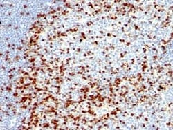 ZAP70 Antibody (ZAP70/528 + 2F3.2), Novus Biologicals 0.02mg; Unlabeled:Antibodies,