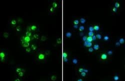 ZAP70, p Tyr352 Antibody (GT1686), Novus Biologicals 100 &mu;g | Buy Online | Novus Biologicals | Fisher Scientific