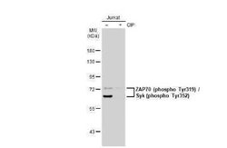 ZAP70, p Tyr352 Antibody (GT1686), Novus Biologicals 100 &mu;g | Buy Online | Novus Biologicals | Fisher Scientific