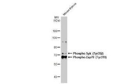 ZAP70, p Tyr352 Antibody (GT1686), Novus Biologicals 100 &mu;g | Buy Online | Novus Biologicals | Fisher Scientific