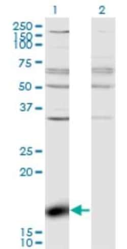 ZBP1/DLM-1/DAI Antibody (2C10), Novus Biologicals 0.1 mg; Unconjugated:Antibodies,