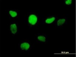 ZBTB14 Antibody, Novus Biologicals 0.05 mg | Buy Online | Novus Biologicals | Fisher Scientific