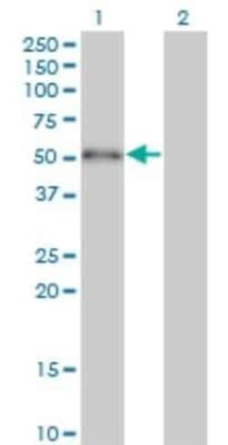 ZBTB25 Antibody (2B8), Novus Biologicals 0.05 mg | Buy Online | Novus Biologicals | Fisher Scientific